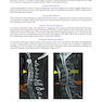 Musculoskeletal Radiology: An Ultimate Guide to Passing the Final FRCR