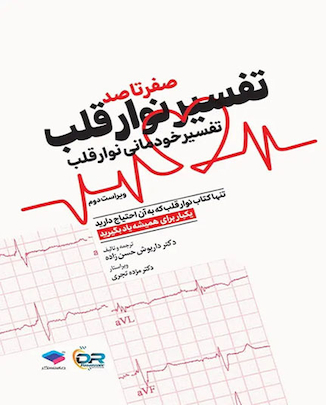 عکس صفر تا صد تفسیر نوار قلب EKG به زبان ساده و خودمانی