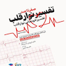صفر تا صد تفسیر نوار قلب EKG به زبان ساده و خودمانی