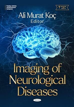 عکس Imaging of Neurological Diseases