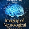 Imaging of Neurological Diseases