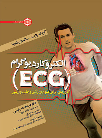 عکس الکتروکاردیوگرام (ECG)