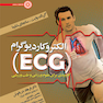 الکتروکاردیوگرام (ECG)