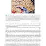 Fundamentals of Neurosurgery: A Guide for Clinicians and Medical Students