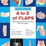 A to Z of Flaps : Mastering Reconstructive Microsurgery