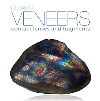 عکس Ceramic Veneers: Contact Lenses and Fragments