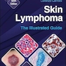 Skin Lymphoma: The Illustrated Guide 6th Edition