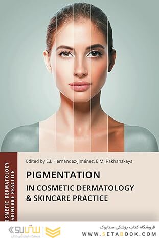 Pigmentation in Cosmetic Dermatology & Skincare Practice