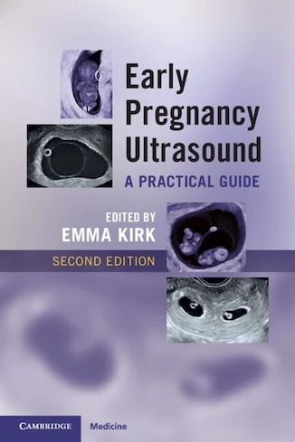 عکس Early Pregnancy Ultrasound: A Practical Guide 2nd Edition